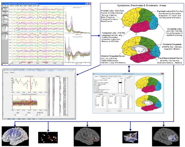 qeeg brain map application